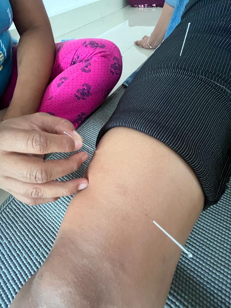Needling