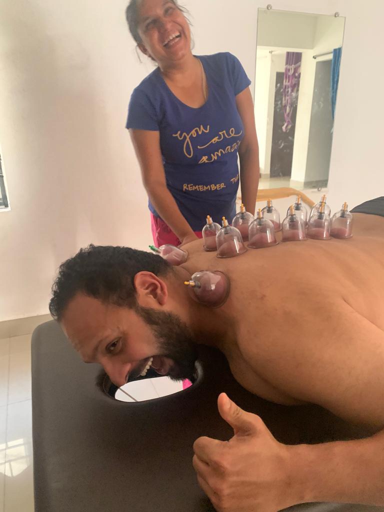 cupping therapy